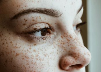 TÀN NHANG LÀ GÌ? PHÂN BIỆT NÁM VÀ TÀN NHANG