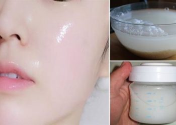 TRỊ NÁM DA MẶT BẰNG PHƯƠNG PHÁP DÂN GIAN, CÓ NÊN THỬ KHÔNG?