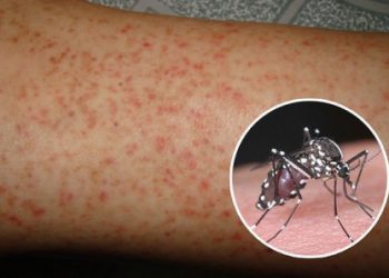 Sốt xuất huyết diễn biến phức tạp tại Hà Nội và TPHCM, cả nước có 102 ca tử vong